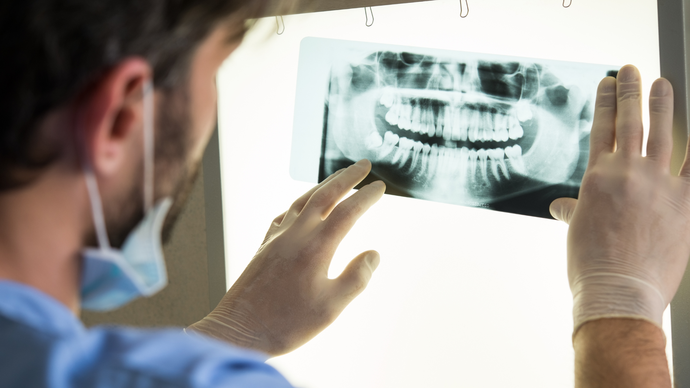 X-Rays at the dentist